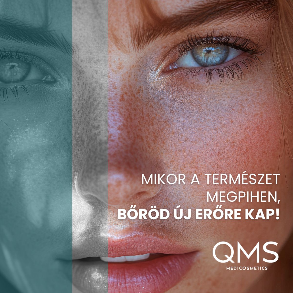 Mikor a természet megpihen, bőröd új erőre kap