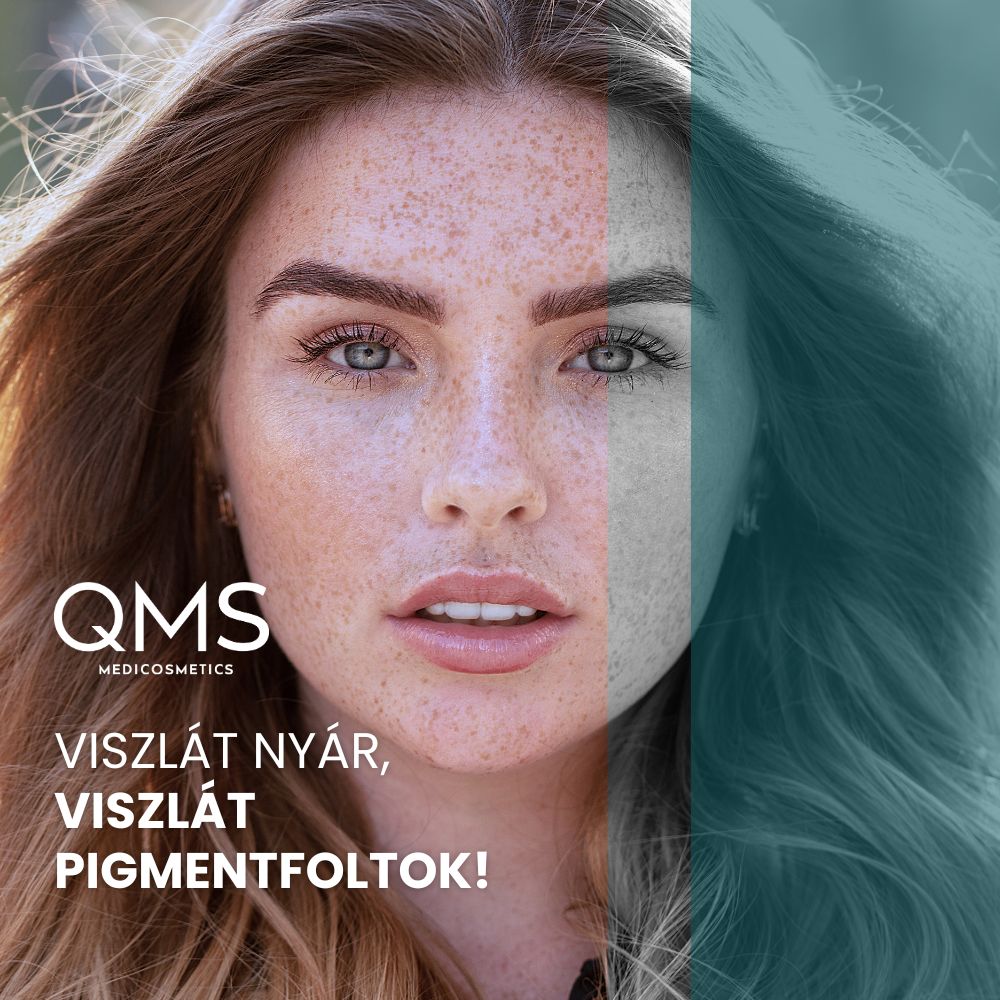 Viszlát nyár, viszlát pigmentfoltok